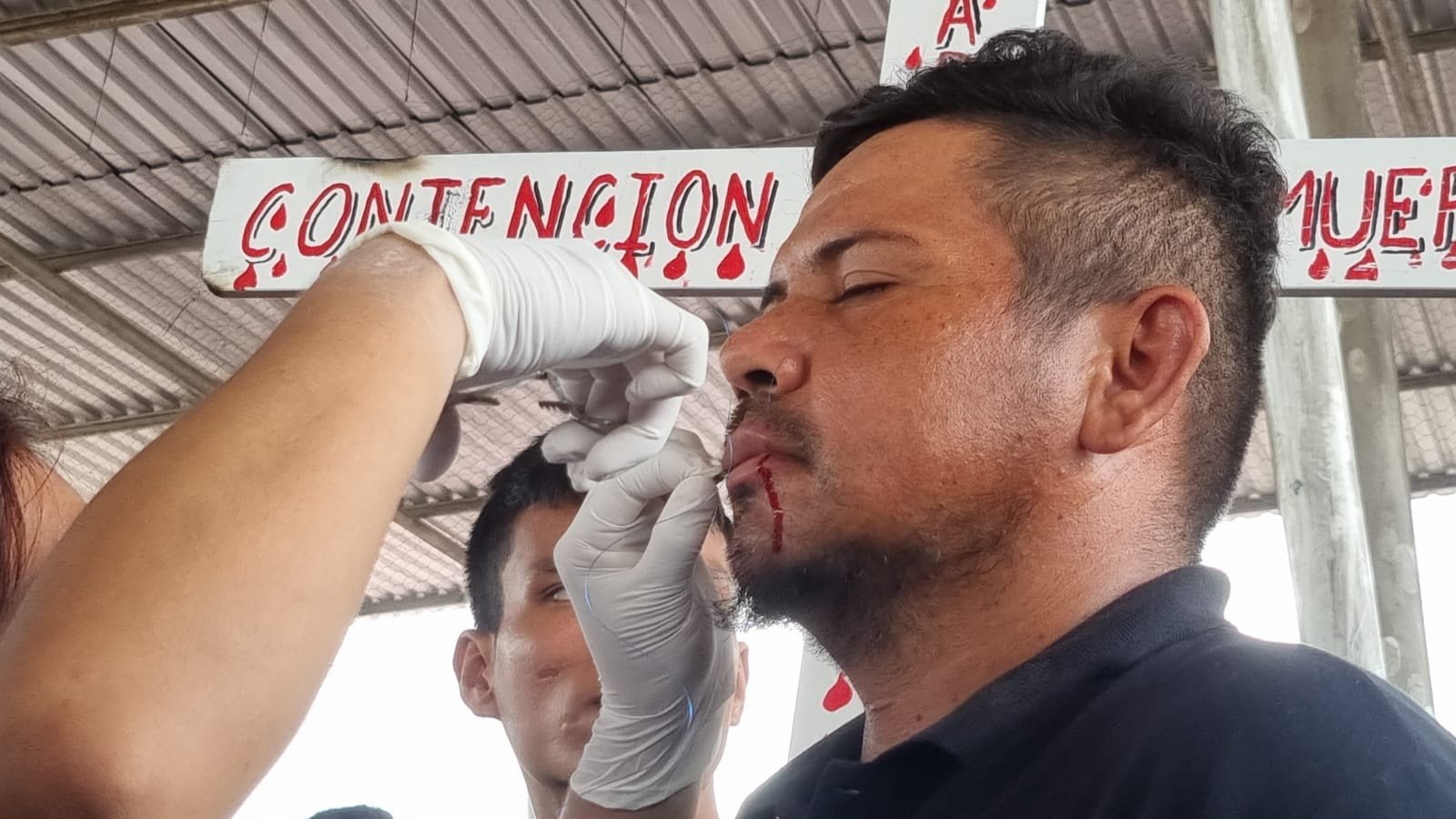 Migrantes en caravana se suturan los labios en forma de protesta!
